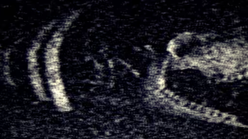 图片[2]-铁肺 /Iron Lung Build.12439138 免安装英文版免费下载